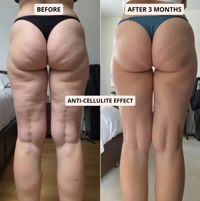 3D Metabollic Anti-Cellulite Leggings