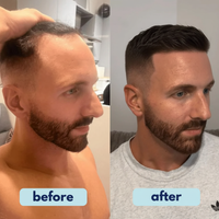 PureVia™ Hair Re-Growth Serum